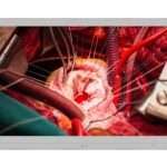 Monitor Cirúrgico LG 27'' 4K IPS